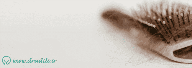 ریزش مو در شیمی درمانی